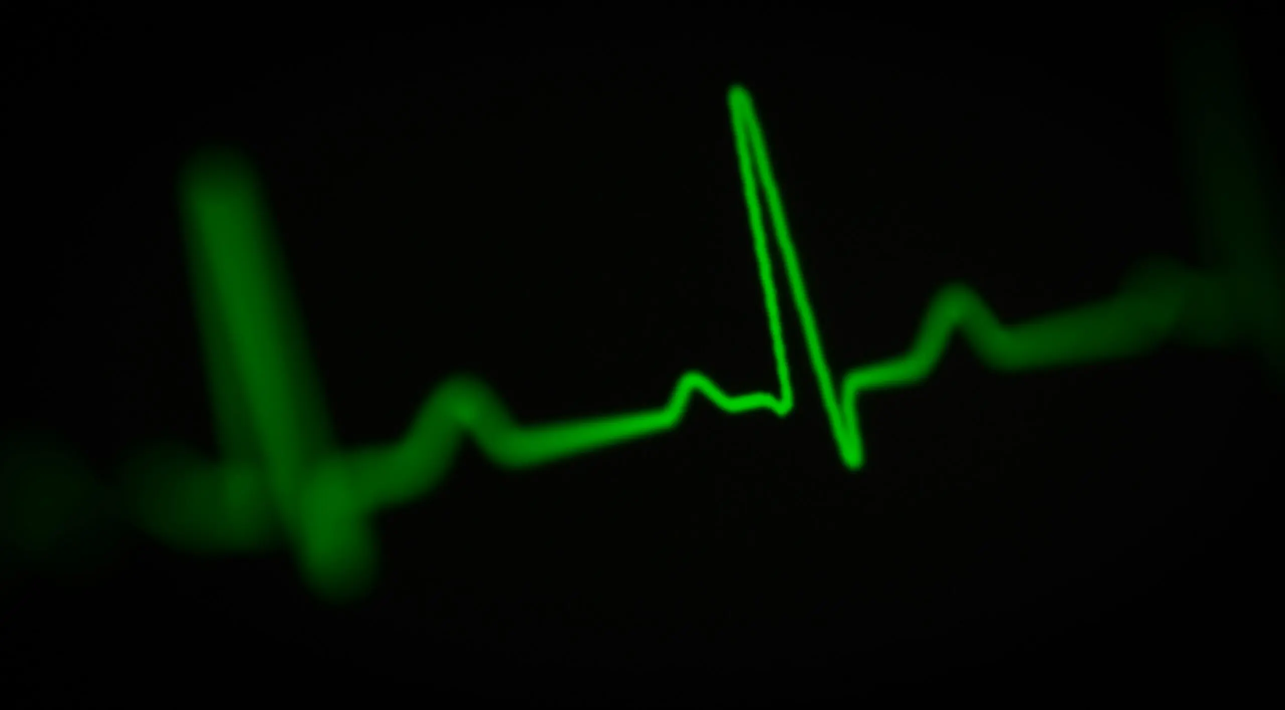EKG Heart Blip